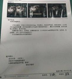 吃打胎药可以吃瓜吗,吃瓜真的没问题吗？